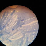 Schimmelbildung unter dem Mikroskop